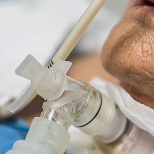 Tracheostomy Care Nurse at Home
